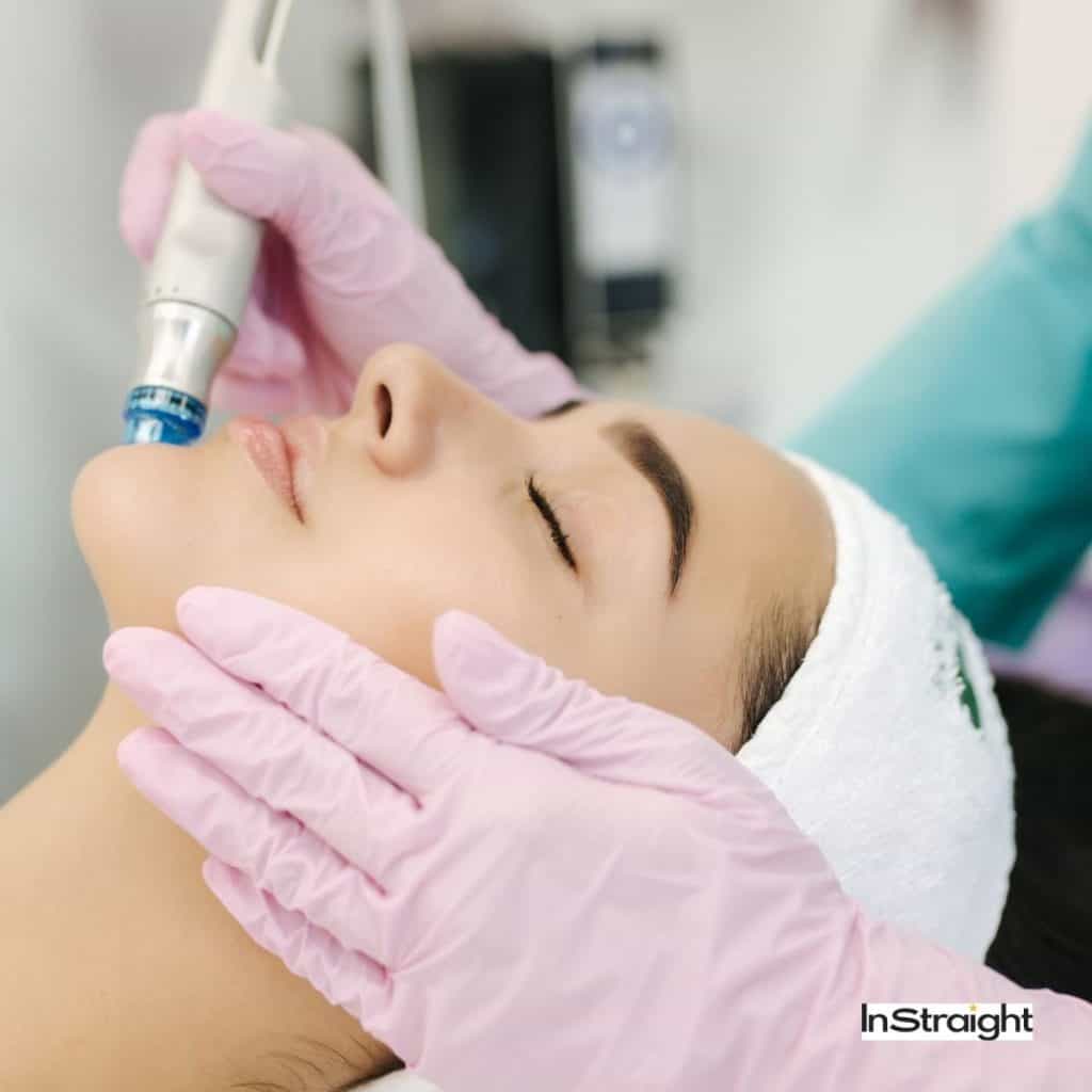 derma pen treatment for flawless face